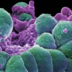 cancer-cells