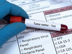 Cancer Detection with MicroRNAs: A Breakthrough in Testicular Cancer Diagnosis