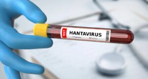 The Hantavirus Scare